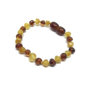 Pulseira – Tornozeleira de Âmbar Barroco Adulto Cognac e Manteiga